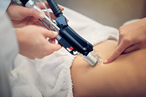 Modern Tattoo Removal Technologies