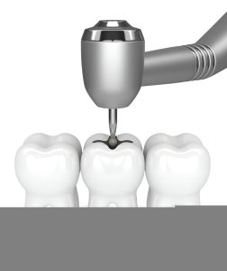 Modern Revolution of Dental Implants