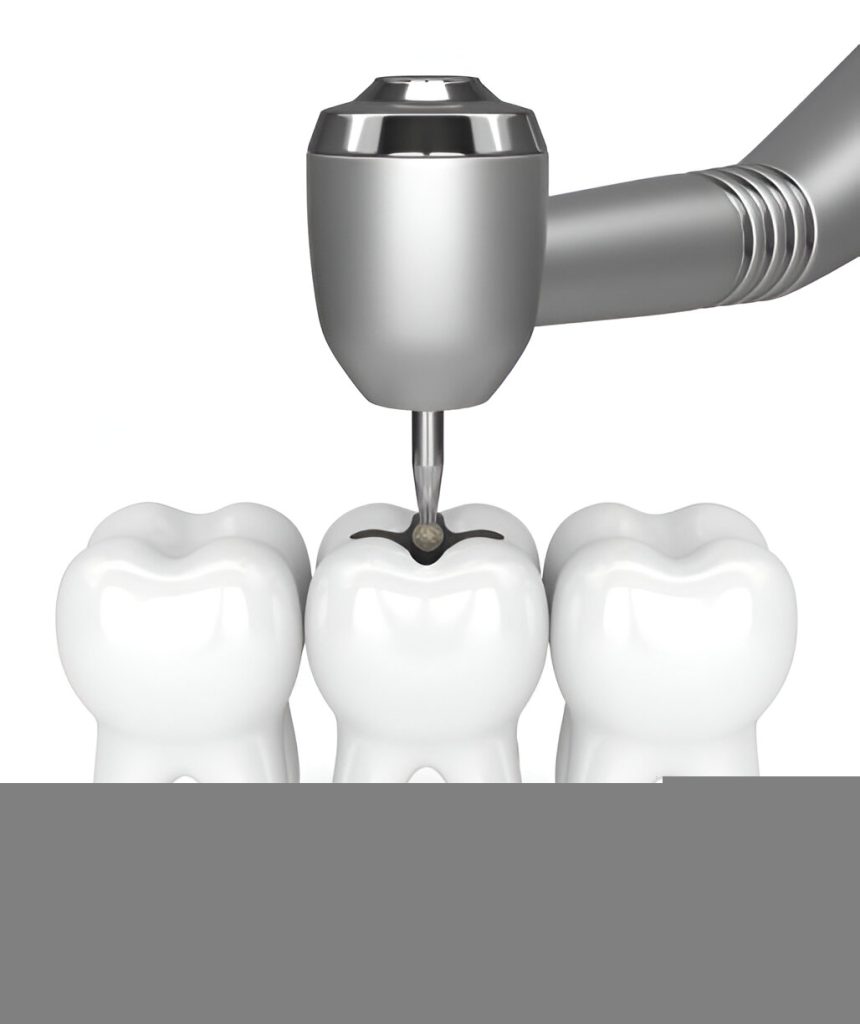 Modern Revolution of Dental Implants