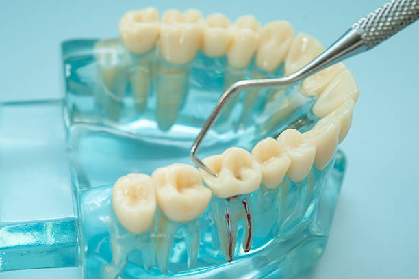 New Dental Implant