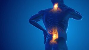 Alleviating Chronic Back Pain